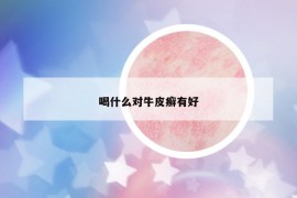 喝什么對牛皮癬有好