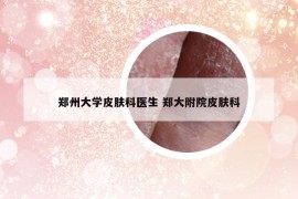 鄭州大學(xué)皮膚科醫(yī)生 鄭大附院皮膚科