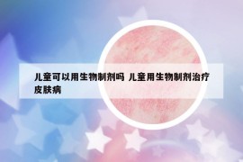 兒童可以用生物制劑嗎 兒童用生物制劑治療皮膚病