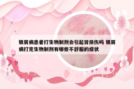 銀屑病患者打生物制劑會(huì)引起腎損傷嗎 銀屑病打完生物制劑有哪些不舒服的癥狀