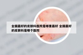 全國最好的皮膚科醫(yī)院是哪里最好 全國最好的皮膚科是哪個(gè)醫(yī)院
