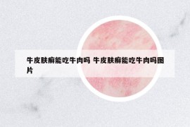 牛皮膚癬能吃牛肉嗎 牛皮膚癬能吃牛肉嗎圖片