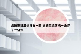 點滴型銀屑病只有一顆 點滴型銀屑病一邊好了一邊長