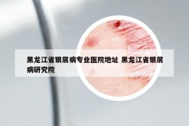 黑龍江省銀屑病專(zhuān)業(yè)醫(yī)院地址 黑龍江省銀屑病研究院