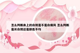 怎么判斷身上的白斑是不是白癜風(fēng) 怎么判斷是長白斑還是膚色不均