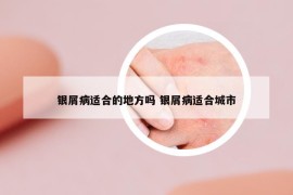 銀屑病適合的地方嗎 銀屑病適合城市