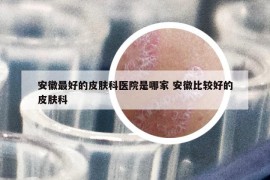 安徽最好的皮膚科醫(yī)院是哪家 安徽比較好的皮膚科