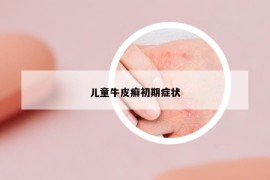 兒童牛皮癬初期癥狀
