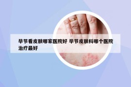 畢節(jié)看皮膚哪家醫(yī)院好 畢節(jié)皮膚科哪個(gè)醫(yī)院治療最好