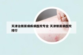 天津治銀屑病疾病醫(yī)院專業(yè) 天津銀屑病醫(yī)院排行