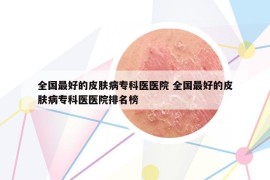 全國(guó)最好的皮膚病專(zhuān)科醫(yī)醫(yī)院 全國(guó)最好的皮膚病專(zhuān)科醫(yī)醫(yī)院排名榜