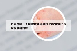 石家莊哪一個醫(yī)院皮膚科最好 石家莊哪個醫(yī)院皮膚科好些