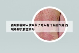 西域蘚霸對人使用長了對人有什么副作用 西域毒癬靈有激素嗎