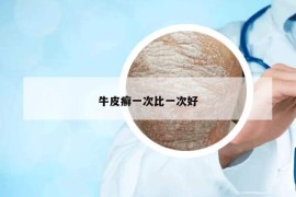牛皮癬一次比一次好