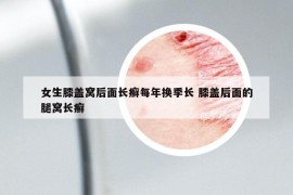 女生膝蓋窩后面長癬每年換季長 膝蓋后面的腿窩長癬