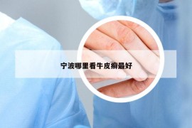寧波哪里看牛皮癬最好