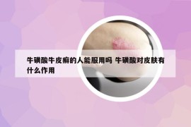 ?；撬崤Ｆぐ_的人能服用嗎 牛磺酸對皮膚有什么作用