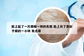 臉上起了一片跟癬一樣的東西 臉上長(zhǎng)了類(lèi)似于癬的一小塊 有點(diǎn)癢