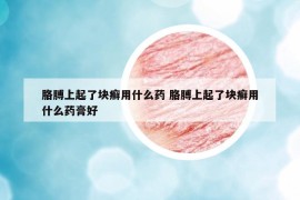 胳膊上起了塊癬用什么藥 胳膊上起了塊癬用什么藥膏好