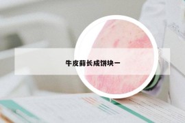 牛皮蘚長成餅塊一