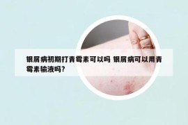 銀屑病初期打青霉素可以嗎 銀屑病可以用青霉素輸液嗎?