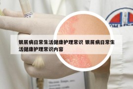 銀屑病日常生活健康護理常識 銀屑病日常生活健康護理常識內(nèi)容