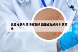 凱里皮膚科醫(yī)院哪家好 凱里皮膚病專科醫(yī)醫(yī)院