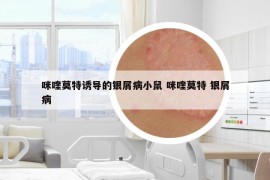 咪喹莫特誘導(dǎo)的銀屑病小鼠 咪喹莫特 銀屑病