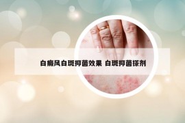 白癜風(fēng)白斑抑菌效果 白斑抑菌搽劑