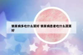 銀屑病多吃什么菜好 銀屑病患者吃什么蔬菜好