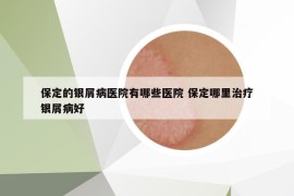 保定的銀屑病醫(yī)院有哪些醫(yī)院 保定哪里治療銀屑病好