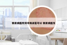 銀屑病醫(yī)院須尋楊淑蓮可以 銀屑病醫(yī)生