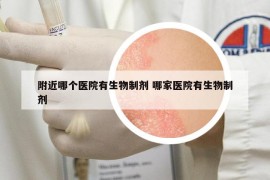 附近哪個(gè)醫(yī)院有生物制劑 哪家醫(yī)院有生物制劑