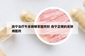 南寧治療牛皮癬哪家醫(yī)院好 南寧正規(guī)的皮膚病醫(yī)院