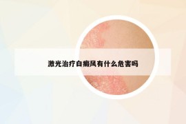 激光治療白癜風有什么危害嗎