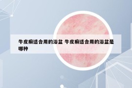 牛皮癬適合用的浴盆 牛皮癬適合用的浴盆是哪種
