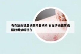 有在濟(jì)南銀屑病醫(yī)院看病嗎 有在濟(jì)南銀屑病醫(yī)院看病嗎現(xiàn)在