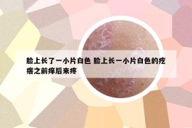 臉上長(zhǎng)了一小片白色 臉上長(zhǎng)一小片白色的疙瘩之前癢后來(lái)疼