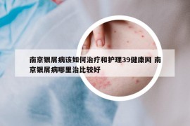 南京銀屑病該如何治療和護(hù)理39健康網(wǎng) 南京銀屑病哪里治比較好