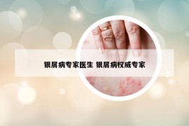 銀屑病專家醫(yī)生 銀屑病權(quán)威專家
