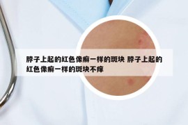 脖子上起的紅色像癬一樣的斑塊 脖子上起的紅色像癬一樣的斑塊不癢