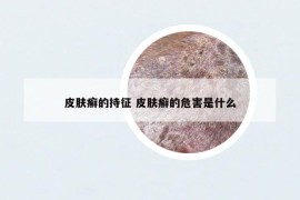 皮膚癬的持征 皮膚癬的危害是什么