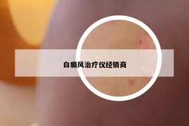 白癜風(fēng)治療儀經(jīng)銷商