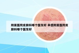 附屬醫(yī)院皮膚科哪個醫(yī)生好 承德附屬醫(yī)院皮膚科哪個醫(yī)生好