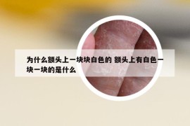 為什么額頭上一塊塊白色的 額頭上有白色一塊一塊的是什么