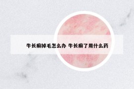 牛長癬掉毛怎么辦 牛長癬了用什么藥