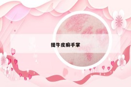 提牛皮癬手掌