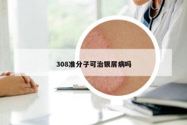 308準(zhǔn)分子可治銀屑病嗎