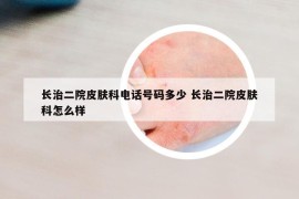 長治二院皮膚科電話號碼多少 長治二院皮膚科怎么樣