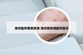 濰坊醫(yī)院看銀屑病 濰坊銀屑病醫(yī)院醫(yī)生